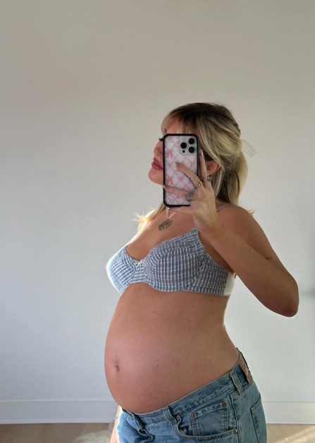 Influencer Admits to Ruining Her Own Plastic Surgery Results