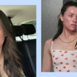 Skinfluencer Madeleine Edwards Doesn’t Let Eczema Flare-Ups Run Her Life